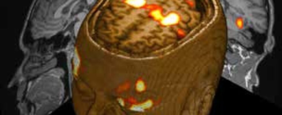 ARTICLE Inside a Brain Scientists Mind